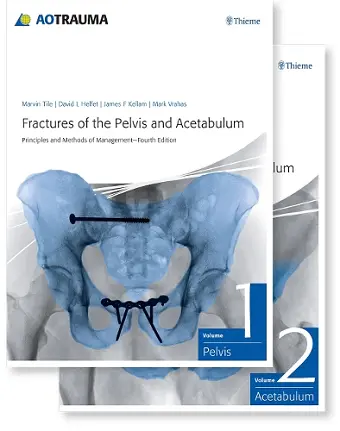Fractures of the Pelvis and Acetabulum (AO) cover