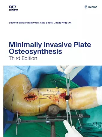 Minimally Invasive Plate Osteosynthesis cover