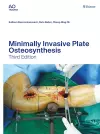 Minimally Invasive Plate Osteosynthesis cover