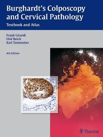 Burghardt's Colposcopy and Cervical Pathology cover