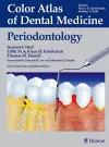 Color Atlas of Dental Medicine: Periodontology cover