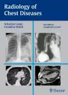 Radiology of Chest Diseases cover