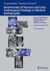 Freyschmidt's "Koehler/Zimmer" Borderlands of Normal and Early Pathological Findings in Skeletal Radiography cover