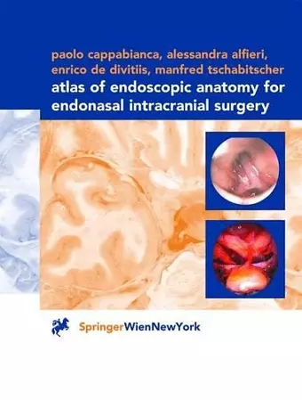 Atlas of Endoscopic Anatomy for Endonasal Intracranial Surgery cover