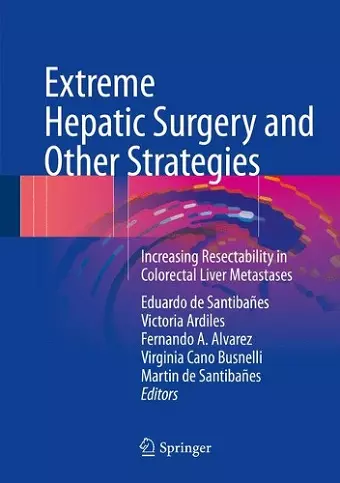 Extreme Hepatic Surgery and Other Strategies cover