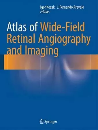 Atlas of Wide-Field Retinal Angiography and Imaging cover