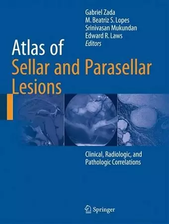 Atlas of Sellar and Parasellar Lesions cover