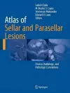 Atlas of Sellar and Parasellar Lesions cover