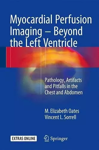 Myocardial Perfusion Imaging - Beyond the Left Ventricle cover