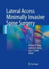 Lateral Access Minimally Invasive Spine Surgery cover