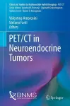 PET/CT in Neuroendocrine Tumors cover