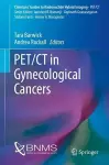 PET/CT in Gynecological Cancers cover