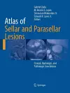 Atlas of Sellar and Parasellar Lesions cover