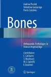 Bones cover