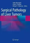 Surgical Pathology of Liver Tumors cover