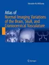 Atlas of Normal Imaging Variations of the Brain, Skull, and Craniocervical Vasculature cover