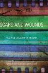 Scars and Wounds cover