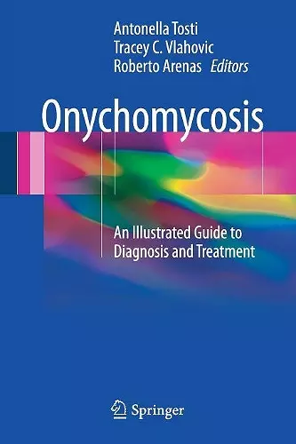 Onychomycosis cover