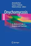 Onychomycosis cover