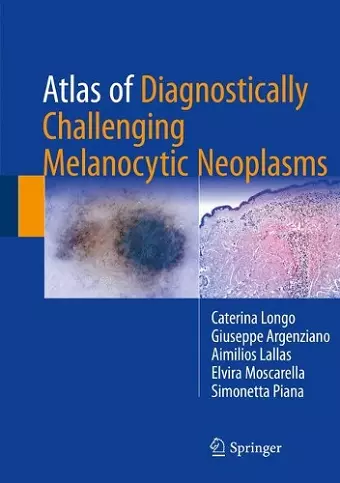 Atlas of Diagnostically Challenging Melanocytic Neoplasms cover