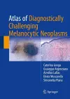 Atlas of Diagnostically Challenging Melanocytic Neoplasms cover