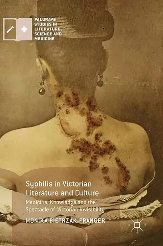 Syphilis in Victorian Literature and Culture cover