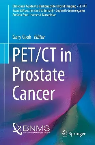 PET/CT in Prostate Cancer cover