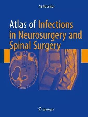 Atlas of Infections in Neurosurgery and Spinal Surgery cover