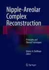 Nipple-Areolar Complex Reconstruction cover
