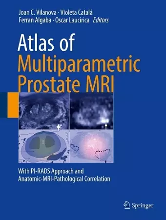 Atlas of Multiparametric Prostate MRI cover