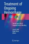 Treatment of Ongoing Hemorrhage cover