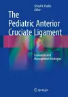 The Pediatric Anterior Cruciate Ligament cover