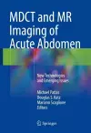 MDCT and MR Imaging of Acute Abdomen cover