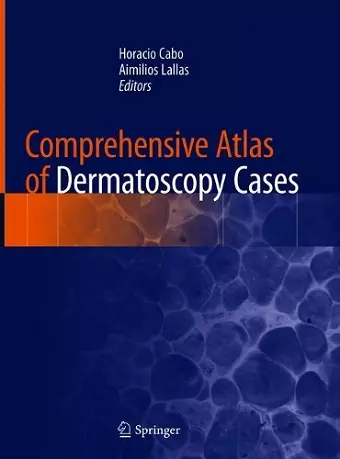 Comprehensive Atlas of Dermatoscopy Cases cover