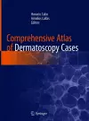 Comprehensive Atlas of Dermatoscopy Cases cover