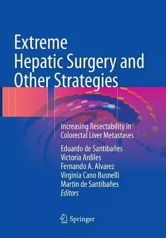 Extreme Hepatic Surgery and Other Strategies cover