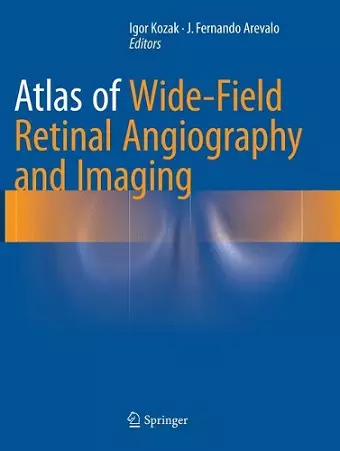 Atlas of Wide-Field Retinal Angiography and Imaging cover