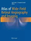 Atlas of Wide-Field Retinal Angiography and Imaging cover