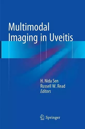 Multimodal Imaging in Uveitis cover