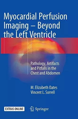 Myocardial Perfusion Imaging - Beyond the Left Ventricle cover