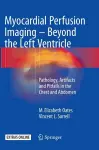 Myocardial Perfusion Imaging - Beyond the Left Ventricle cover