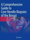 A Comprehensive Guide to Core Needle Biopsies of the Breast cover