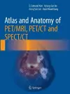 Atlas and Anatomy of PET/MRI, PET/CT and SPECT/CT cover