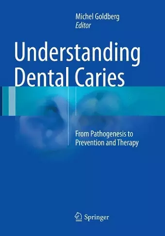 Understanding Dental Caries cover