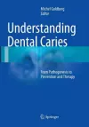 Understanding Dental Caries cover