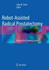 Robot-Assisted Radical Prostatectomy cover