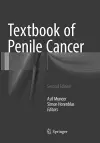 Textbook of Penile Cancer cover