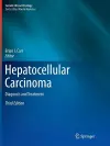 Hepatocellular Carcinoma cover