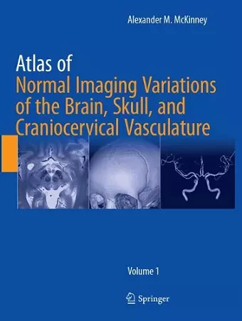 Atlas of Normal Imaging Variations of the Brain, Skull, and Craniocervical Vasculature cover