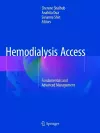 Hemodialysis Access cover